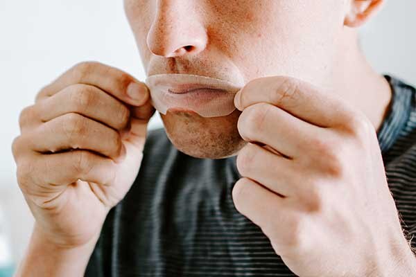 Fitting SomniFix Over Mouth
